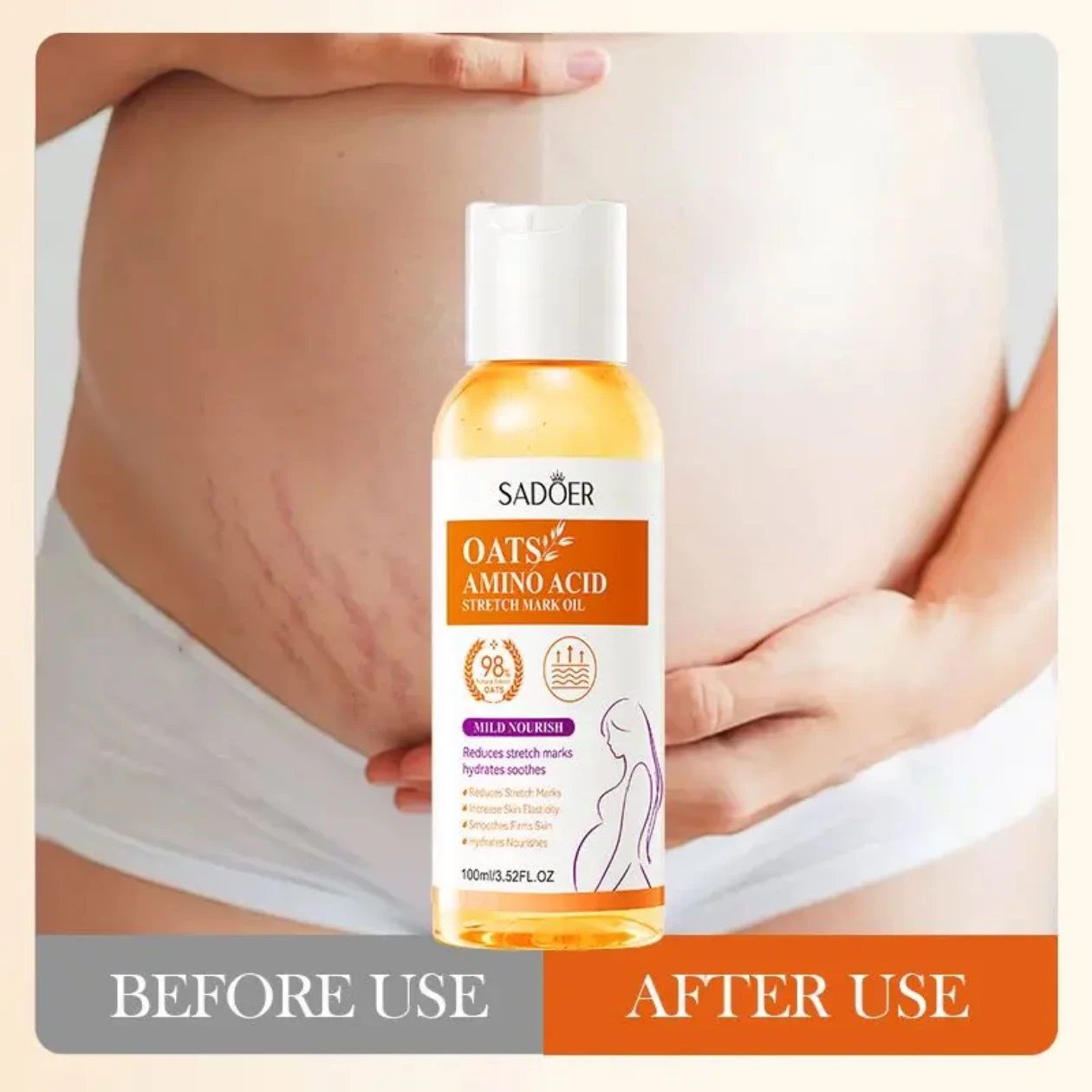 Sadoer Oats Amino Acid Stretch Mark Oil