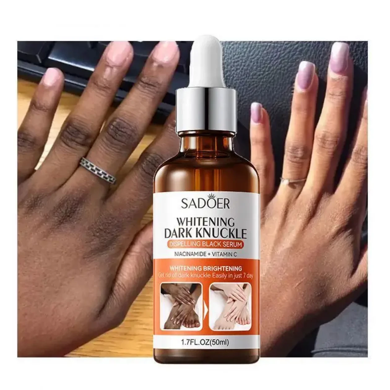 Dark Knuckle Whitening Serum 50ml
