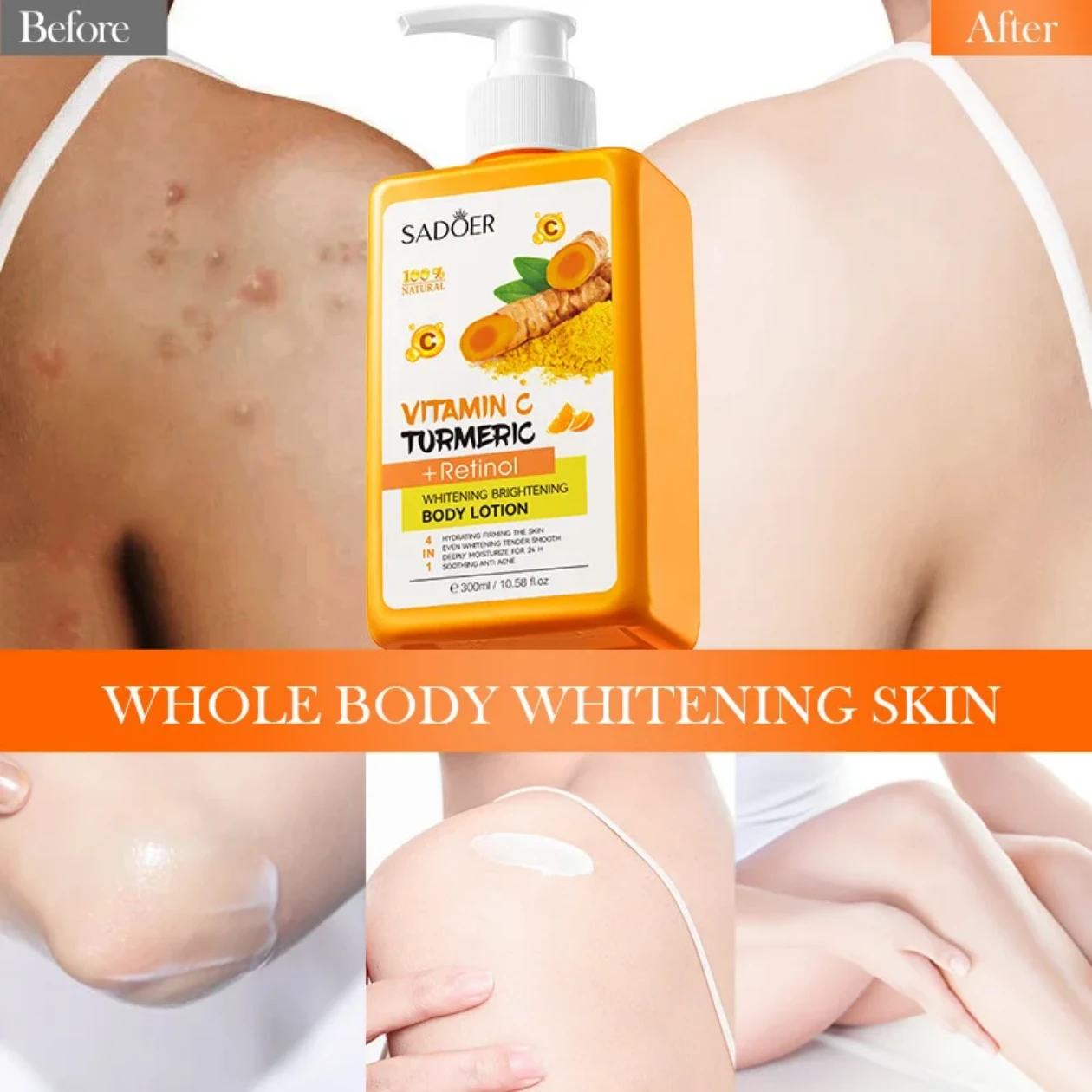 Vitamin C Turmeric Body Lotion