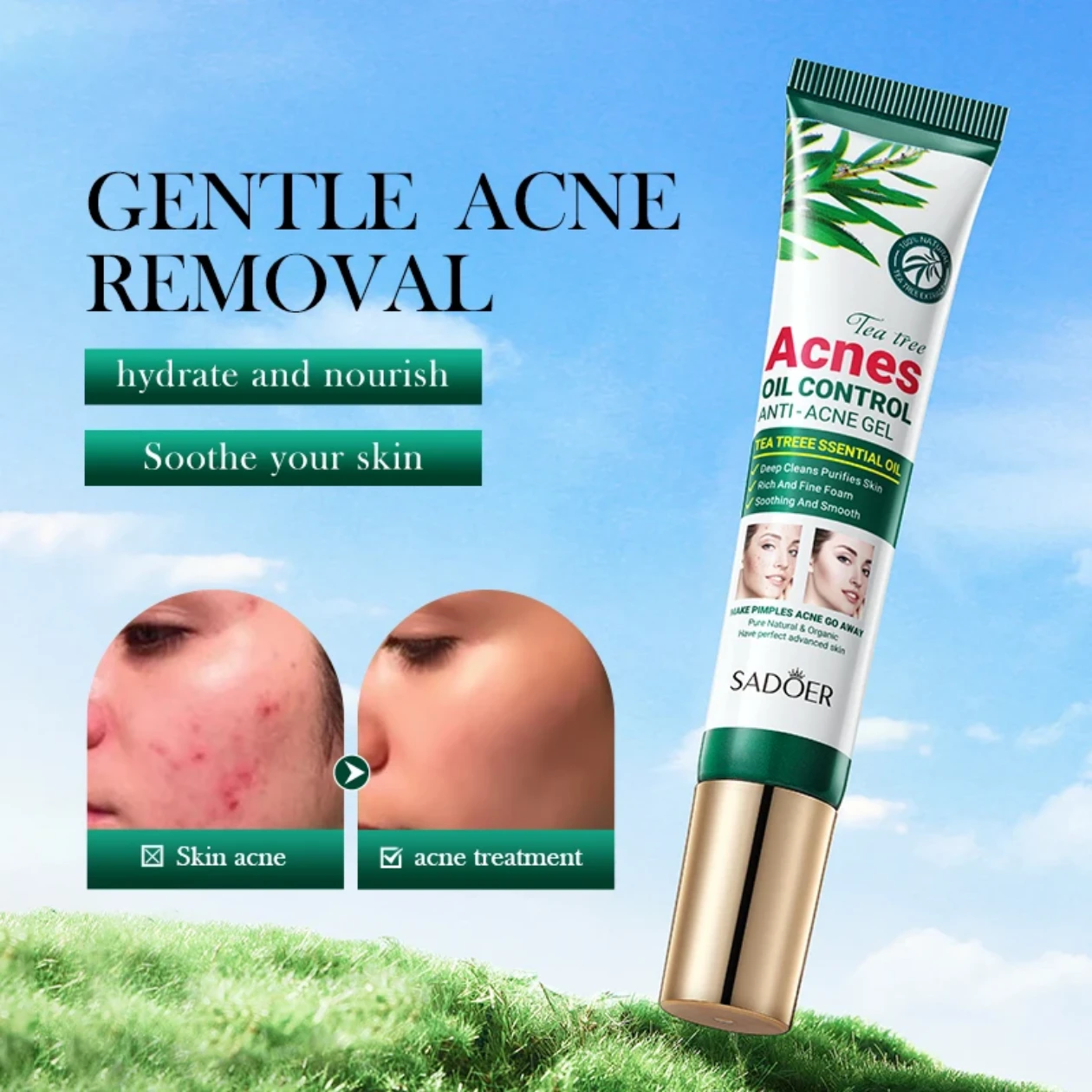 Tea Tree Anti-Acne Oil Control Gel