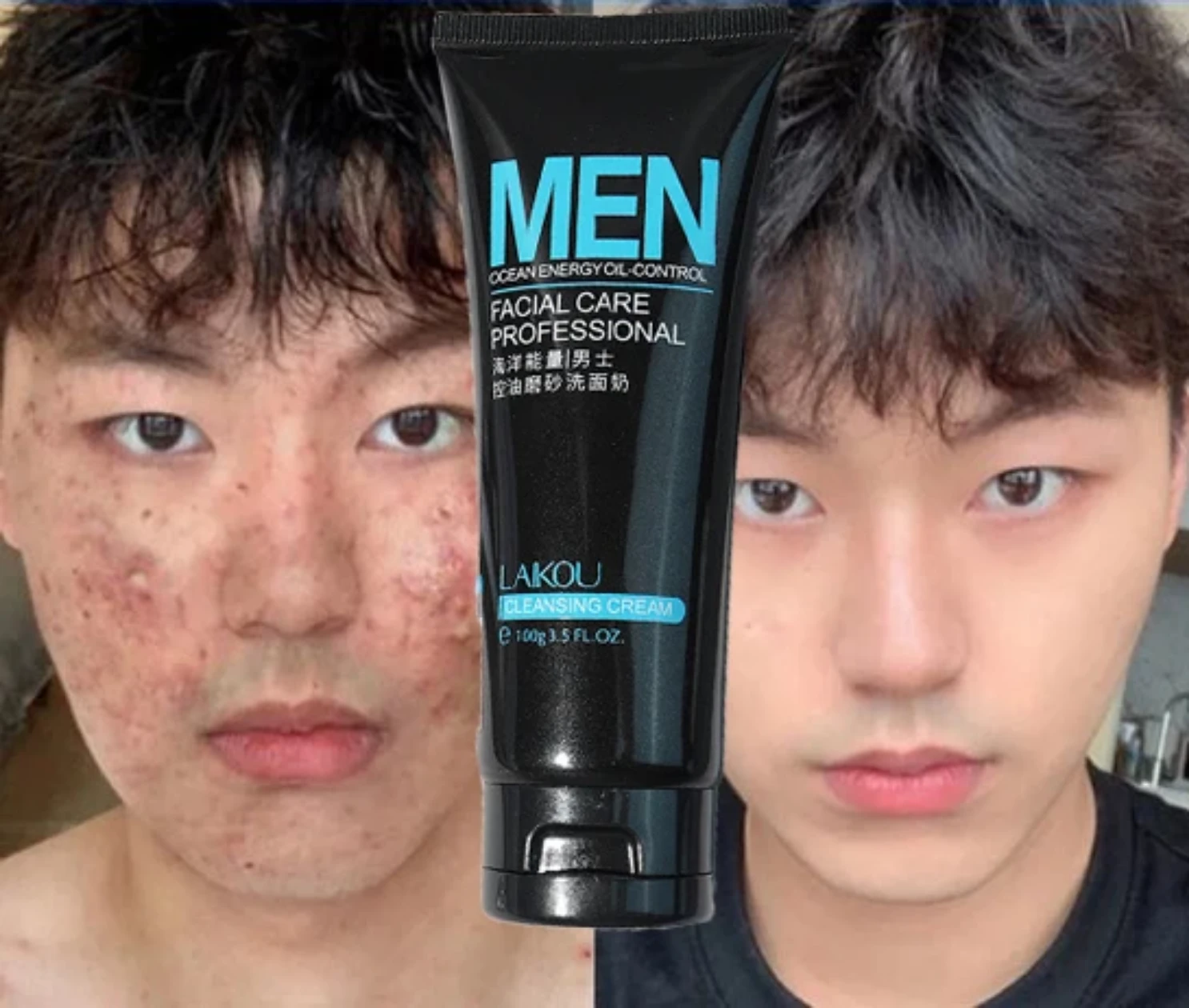 Men's Facial Care Oil Control Cleanser