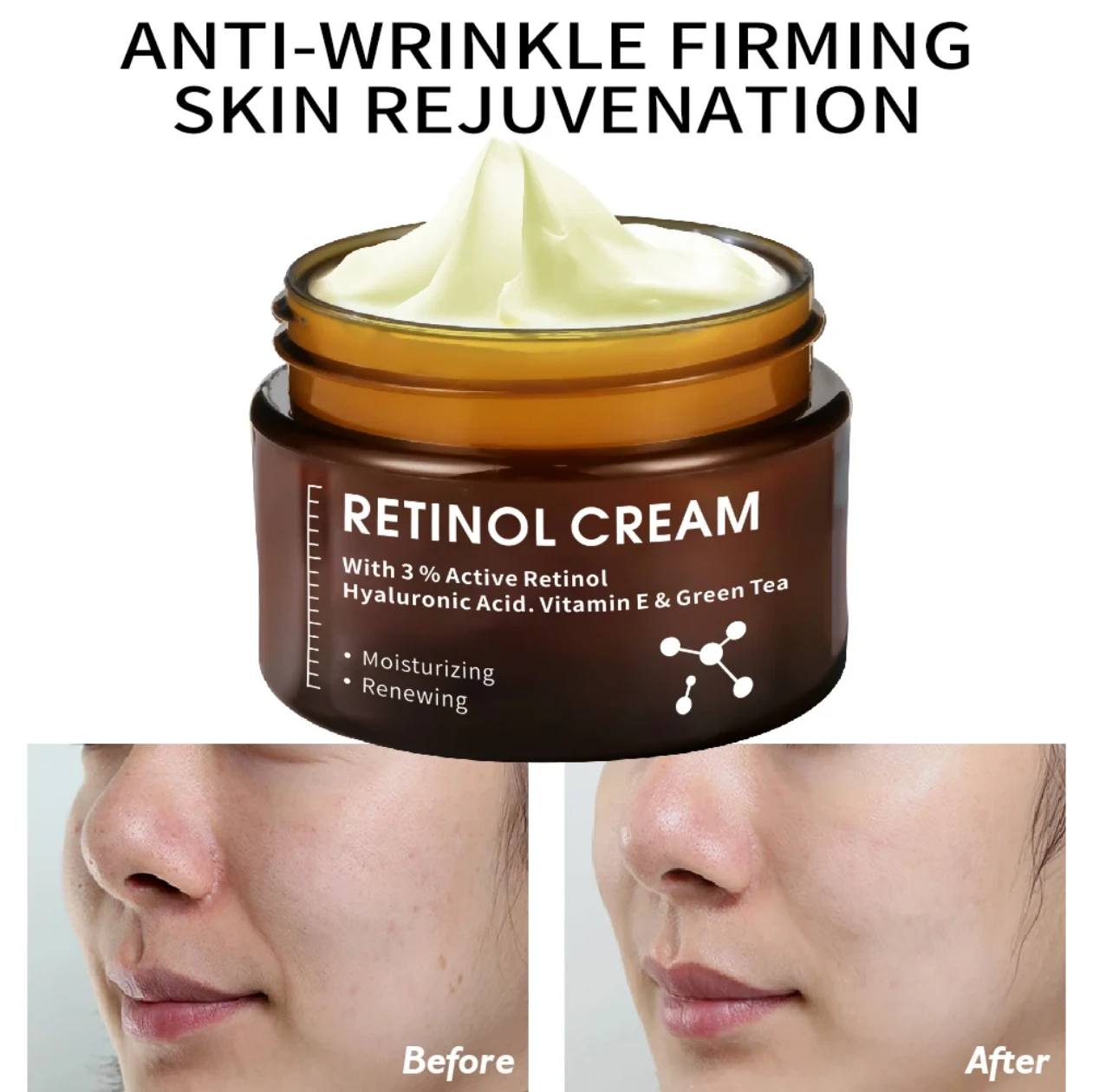 Retinol Cream with Hyaluronic Acid and Vitamin E