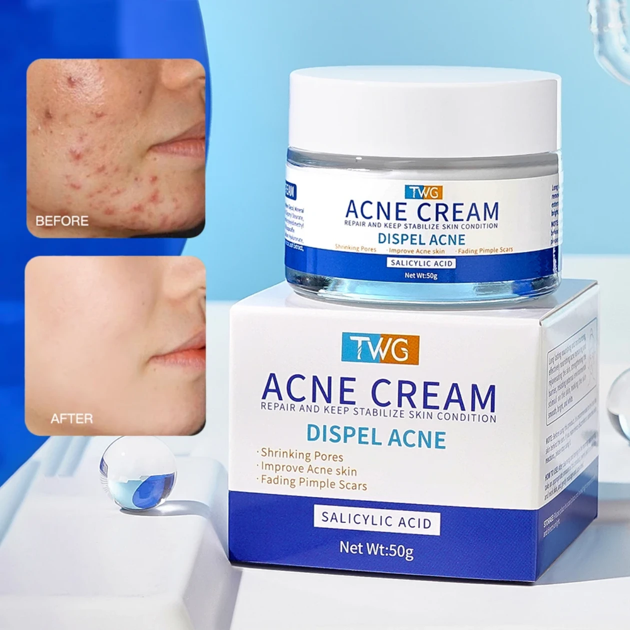 TWG Acne Cream with Salicylic Acid